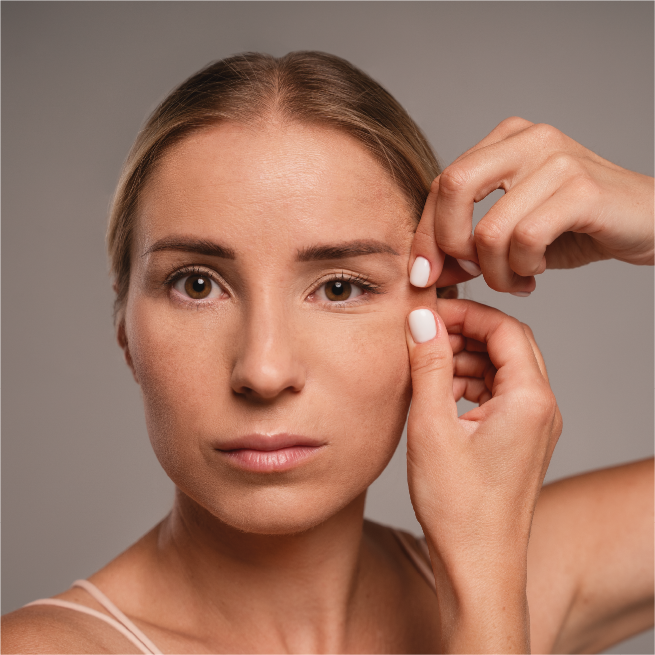 Blefaroplastia